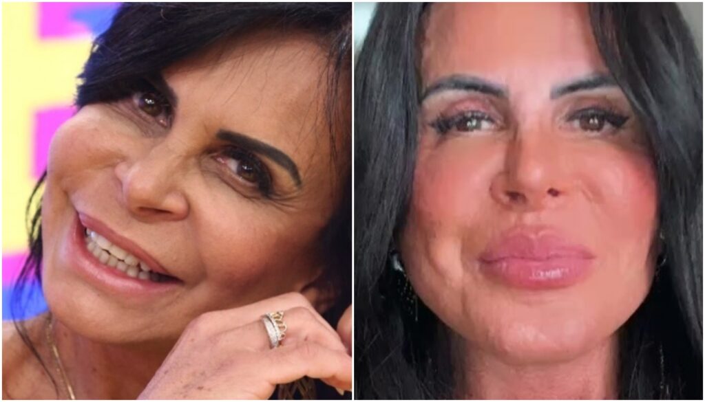Antes e depois de Gretchen