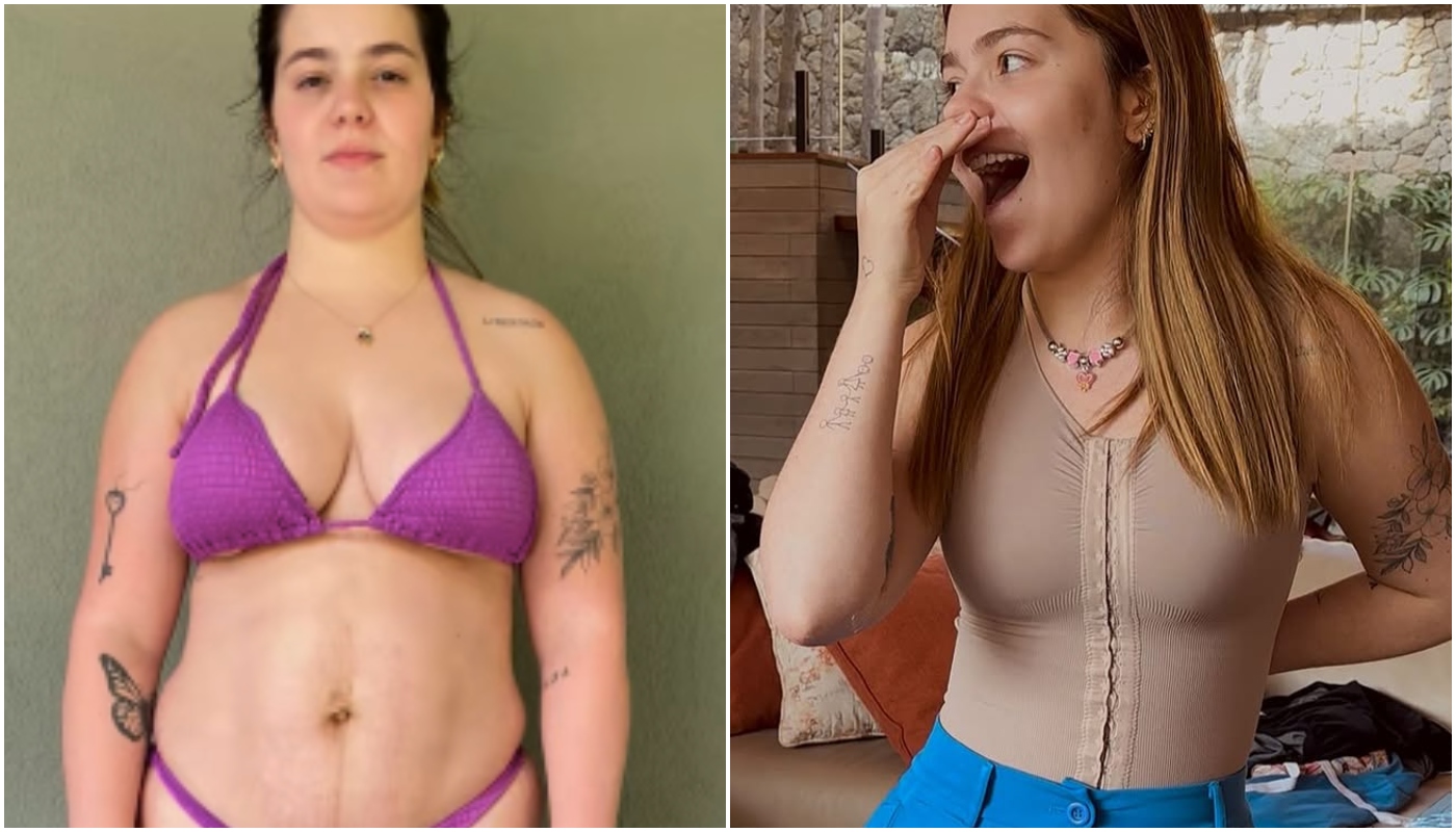 Antes e depois de viih tube