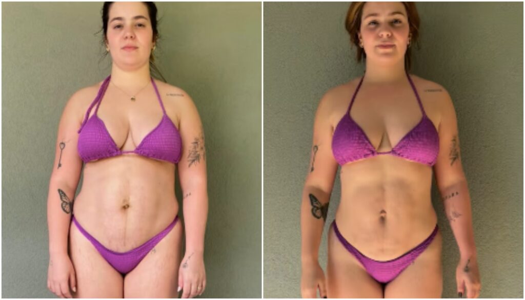 Antes e depois de viih tube