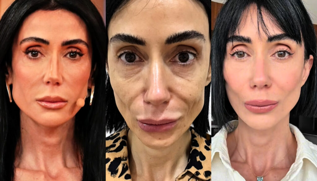 Antes e depois de Michelle Barros