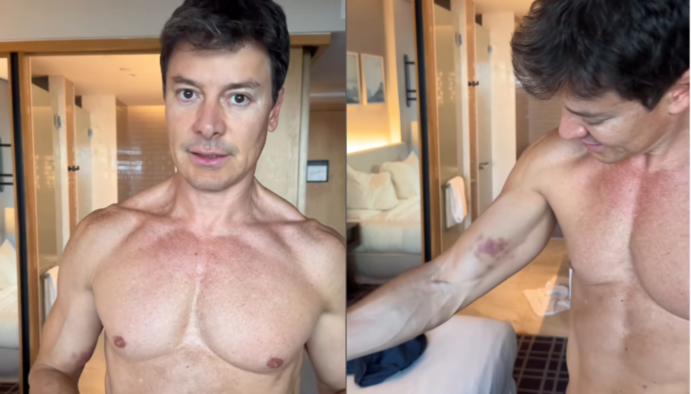 Rodrigo Faro mostra hematomas no corpo após ensaios: “Isso é Dança dos Famosos”