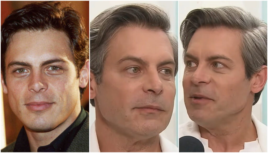 Com toxina botulínica, Luigi Baricelli buscou acabar com “ar de cansado” e resgatar Fred de “Laços de Família”