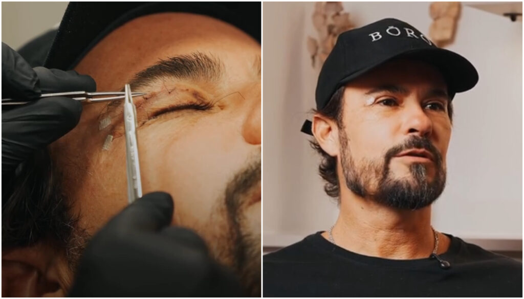 Aos 46 anos, o ator Paulinho Vilhena passou por uma blefaroplastia