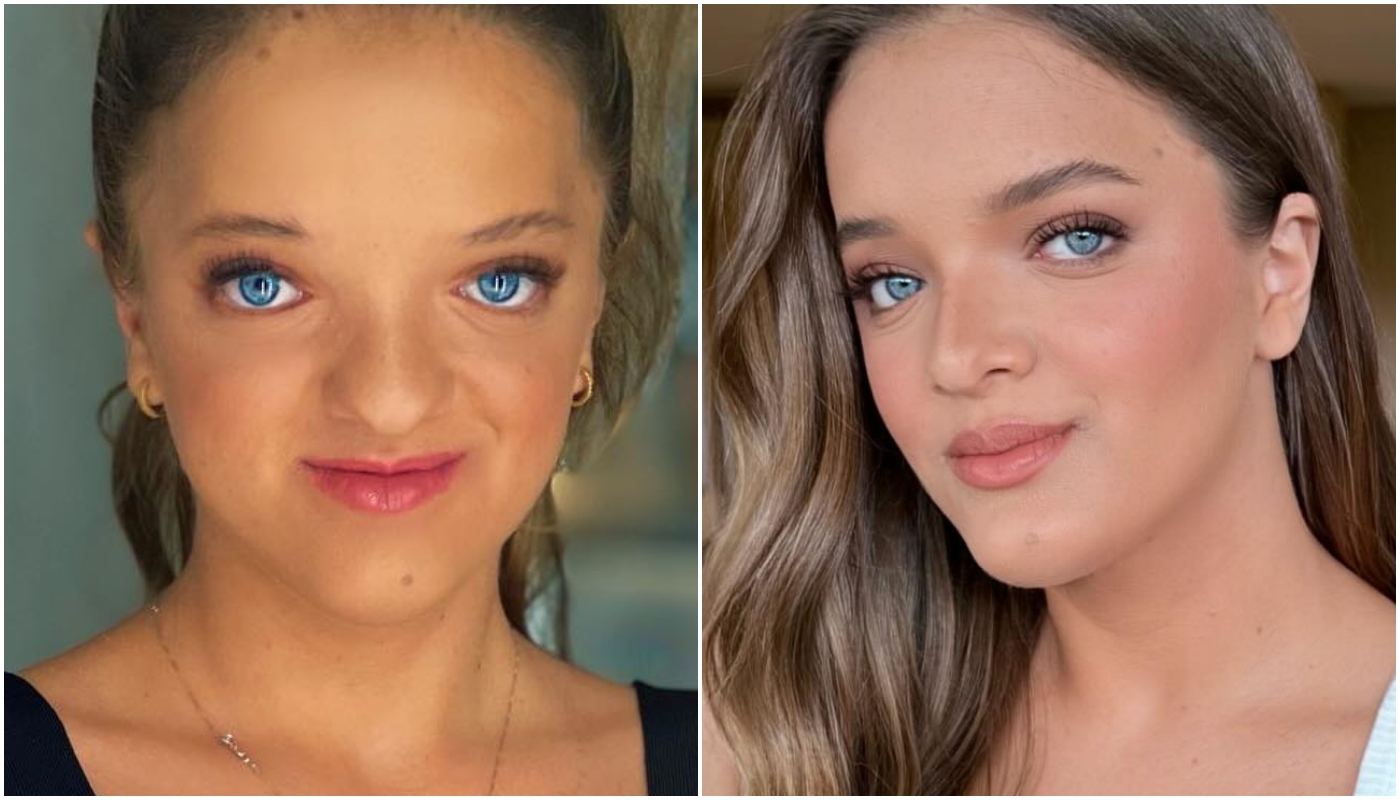 Rafa Justus antes e depois