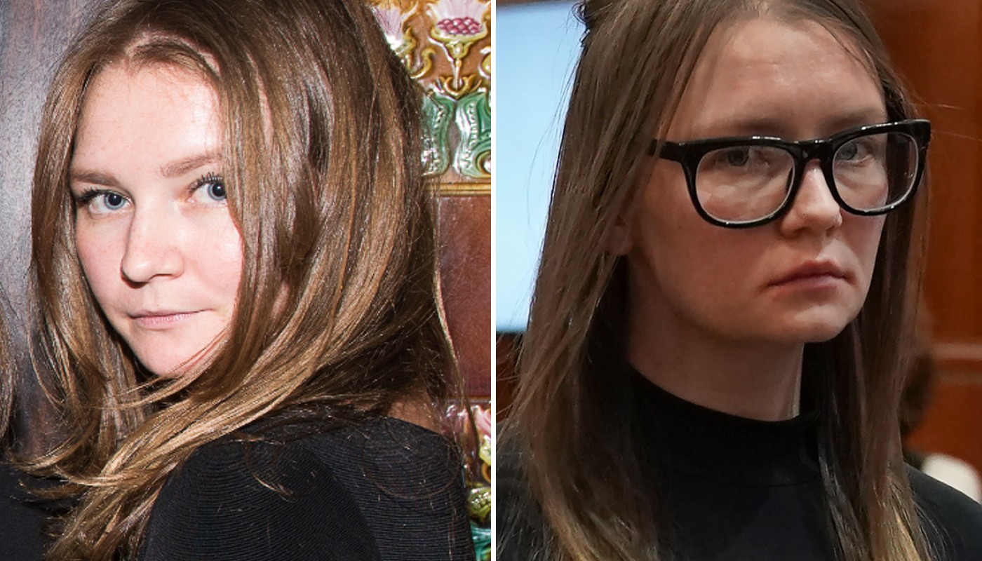 Antes e depois de Anna
