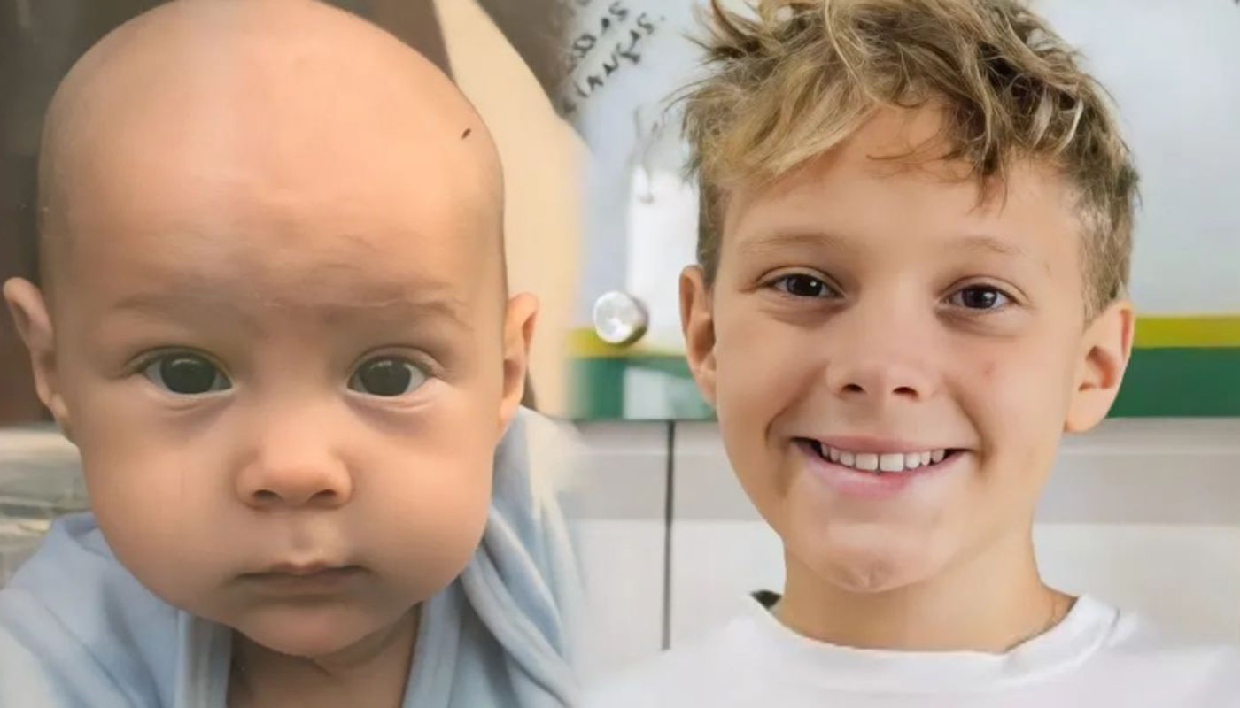 Antes e depois de Davi Lucca