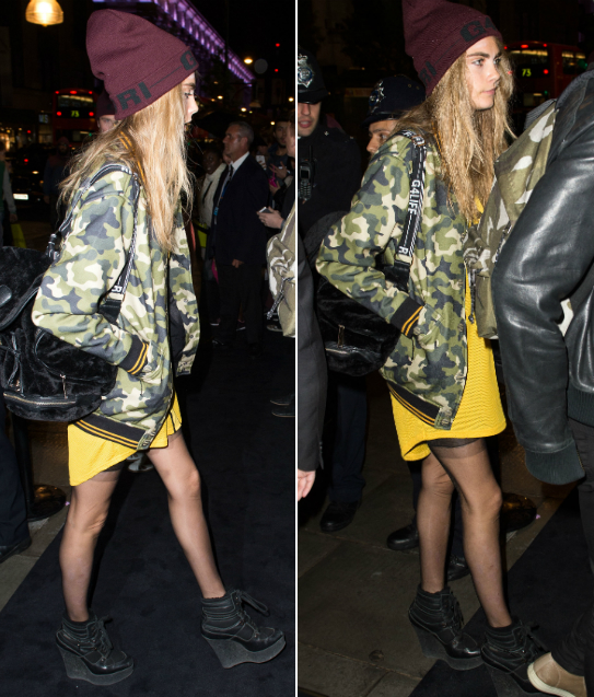 Famosas com as pernas mais finas: bonito ou magreza excessiva? Veja fotos