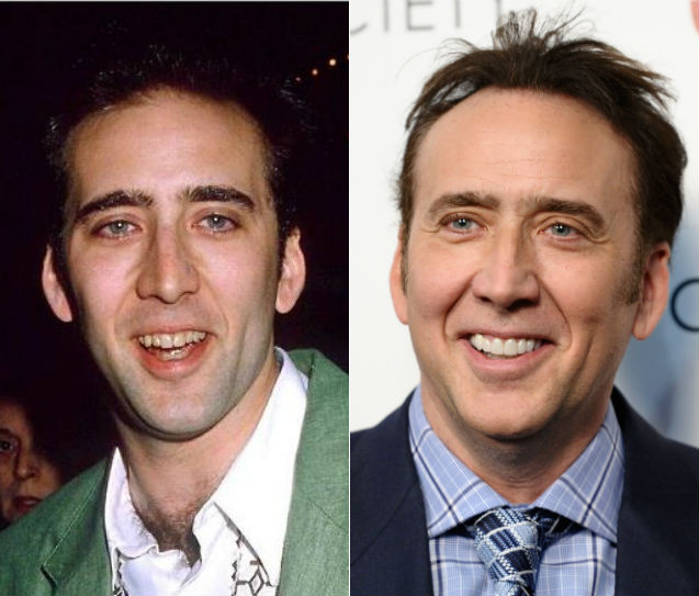 Transformações no sorriso dos famosos: veja antes e depois quem arrumou os dentes