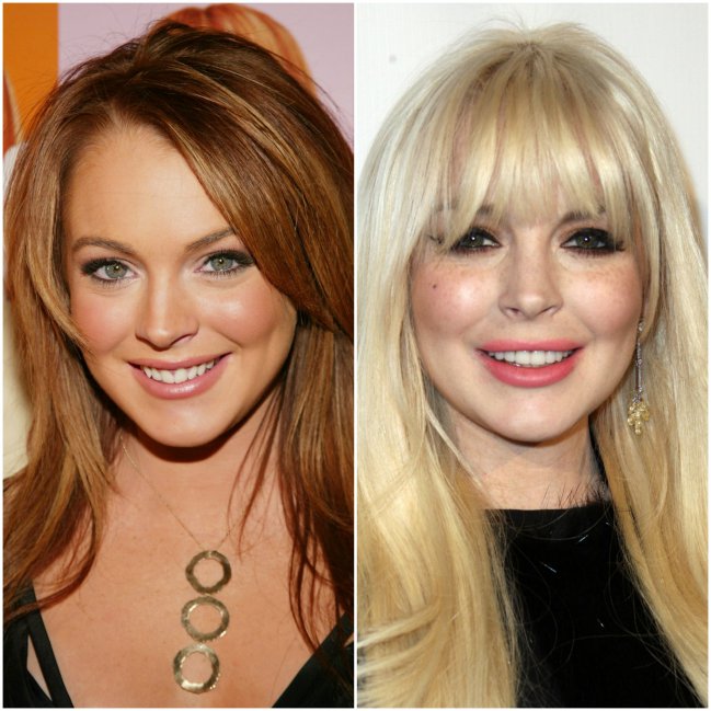 10 famosas que eram mais bonitas antes de fazer cirurgias plásticas: compare fotos